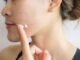 Tretinoin Picture Ii