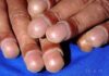 Nails 1 1